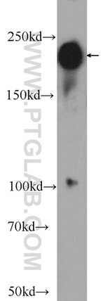 ABCA7 Antibody in Western Blot (WB)