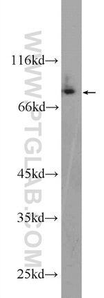 CPEB4 Antibody in Western Blot (WB)