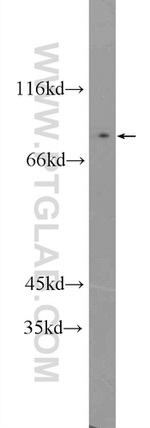 CPEB4 Antibody in Western Blot (WB)