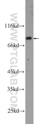 CPEB4 Antibody in Western Blot (WB)