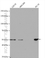 AGTR1 Antibody in Western Blot (WB)