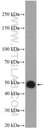 AGTR1 Antibody in Western Blot (WB)