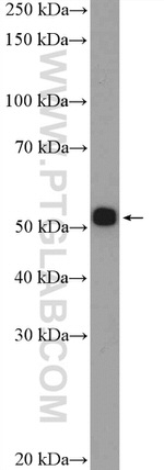 AGTR1 Antibody in Western Blot (WB)