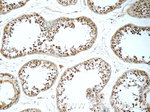 SENP1 Antibody in Immunohistochemistry (Paraffin) (IHC (P))