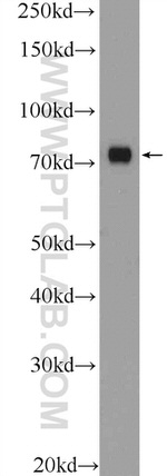 SENP1 Antibody in Western Blot (WB)