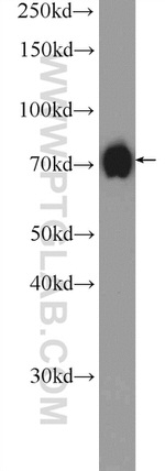 SENP1 Antibody in Western Blot (WB)