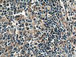 NOX5 Antibody in Immunohistochemistry (Paraffin) (IHC (P))