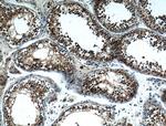 NOX5 Antibody in Immunohistochemistry (Paraffin) (IHC (P))