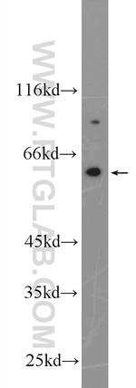 NOX5 Antibody in Western Blot (WB)