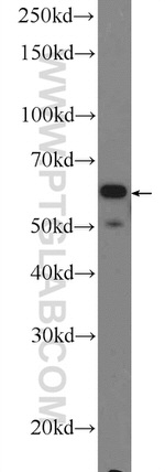 NOX5 Antibody in Western Blot (WB)