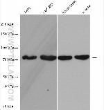 TTC30A Antibody in Western Blot (WB)