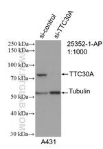 TTC30A Antibody in Western Blot (WB)