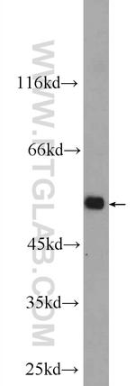 PROC Antibody in Western Blot (WB)