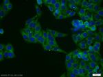 CYTSA Antibody in Immunocytochemistry (ICC/IF)