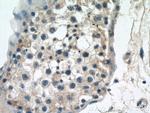 CYTSA Antibody in Immunohistochemistry (Paraffin) (IHC (P))