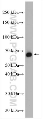 HSP70 Antibody in Western Blot (WB)