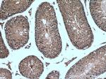 SRPK2 Antibody in Immunohistochemistry (Paraffin) (IHC (P))