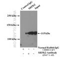 SRPK2 Antibody in Immunoprecipitation (IP)