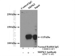 SRPK2 Antibody in Immunoprecipitation (IP)