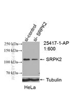 SRPK2 Antibody in Western Blot (WB)