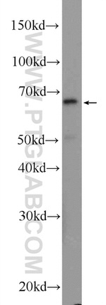 KIAA0907 Antibody in Western Blot (WB)