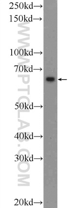 KIAA0907 Antibody in Western Blot (WB)