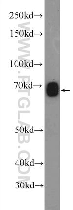 KIAA0907 Antibody in Western Blot (WB)