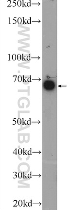 KIAA0907 Antibody in Western Blot (WB)