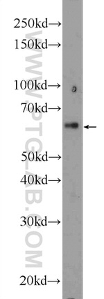 KIAA0907 Antibody in Western Blot (WB)