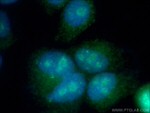 DKC1 Antibody in Immunocytochemistry (ICC/IF)