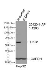 DKC1 Antibody in Western Blot (WB)