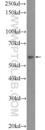 DKC1 Antibody in Western Blot (WB)