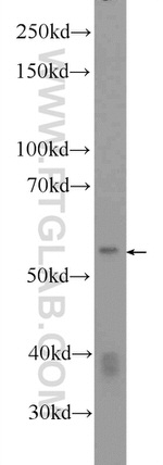 DKC1 Antibody in Western Blot (WB)