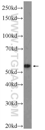 DKC1 Antibody in Western Blot (WB)