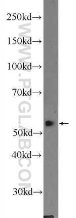 DKC1 Antibody in Western Blot (WB)