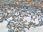 BIVM Antibody in Immunohistochemistry (Paraffin) (IHC (P))