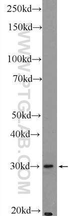 BIVM Antibody in Western Blot (WB)