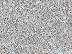 TWIST1 Antibody in Immunohistochemistry (Paraffin) (IHC (P))