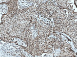 TWIST1 Antibody in Immunohistochemistry (Paraffin) (IHC (P))