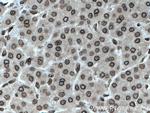 TWIST1 Antibody in Immunohistochemistry (Paraffin) (IHC (P))