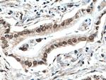 TWIST1 Antibody in Immunohistochemistry (Paraffin) (IHC (P))