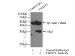 TWIST1 Antibody in Immunoprecipitation (IP)