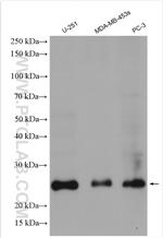 TWIST1 Antibody in Western Blot (WB)