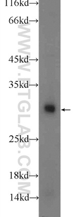 TWIST1 Antibody in Western Blot (WB)