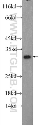 TWIST1 Antibody in Western Blot (WB)