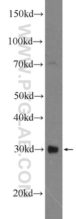 TWIST1 Antibody in Western Blot (WB)