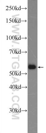 SAAL1 Antibody in Western Blot (WB)