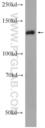 STK10 Antibody in Western Blot (WB)