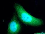 ZNF215 Antibody in Immunocytochemistry (ICC/IF)