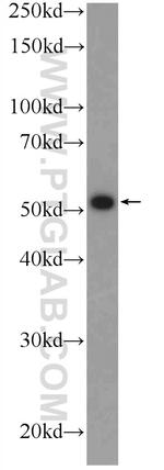 ZNF215 Antibody in Western Blot (WB)